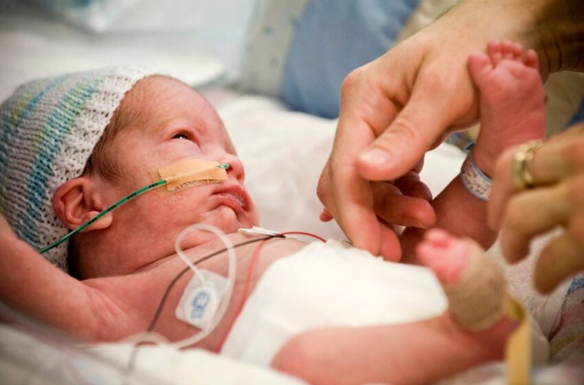  Día Mundial del Prematuro: ‘’Entre un 15 y un 20 % de los recién nacidos requieren internación en una terapia intensiva neonatal’’